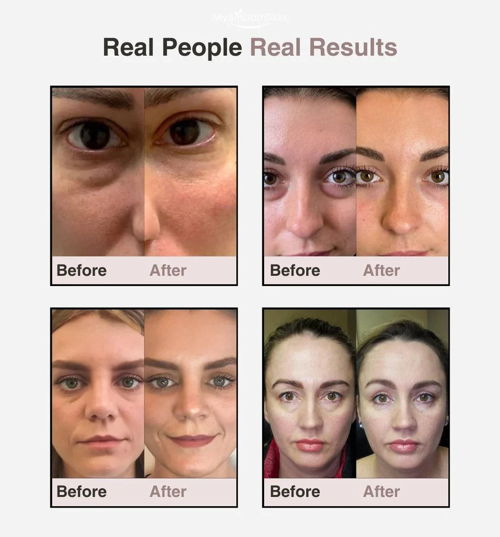 Soothing Remover Eye Bags Eye Massager