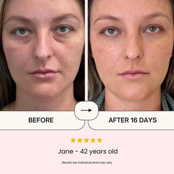 Soothing Remover Eye Bags Eye Massager